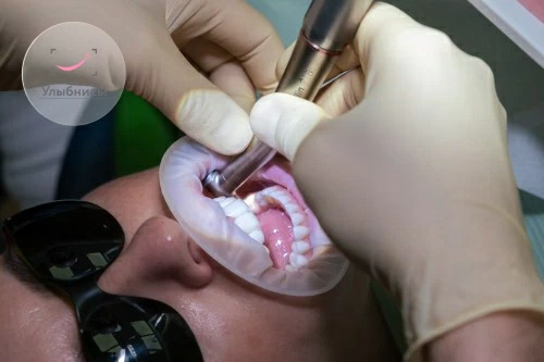 Особенности протезирования передних верхних зубов