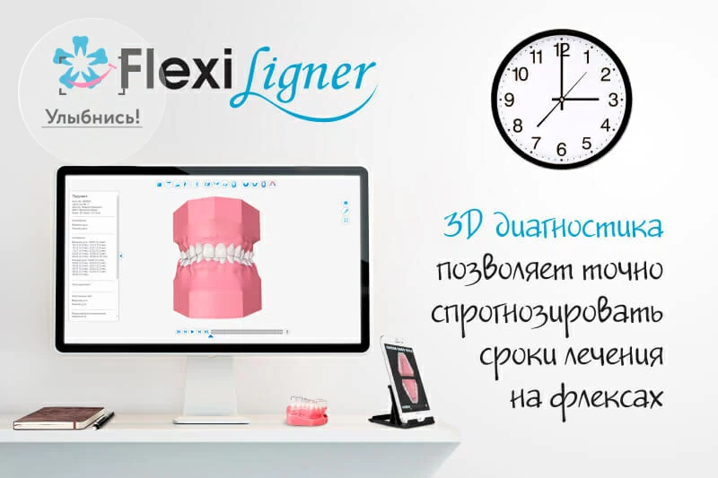 Капы для выравнивания зубов Flexiligner