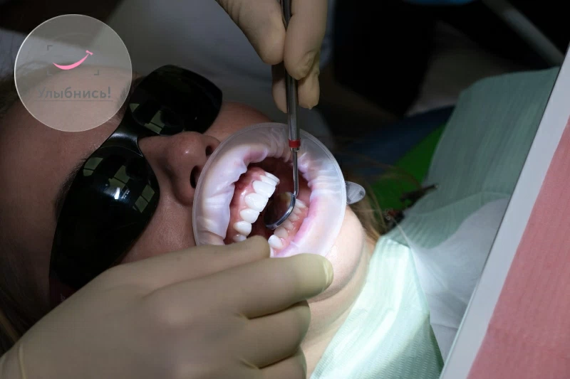 Все о протезировании зубов – часть 1