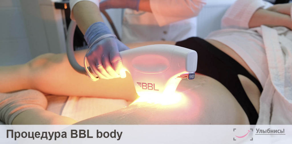 BBL Body (тело)