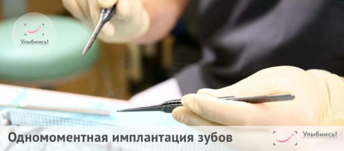 Одномоментная имплантация зубов